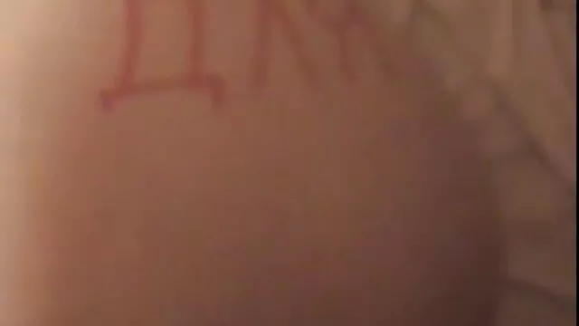 کودکی که مجروح پخش زنده فیلم سوپر شده است با موسیقی در زمان