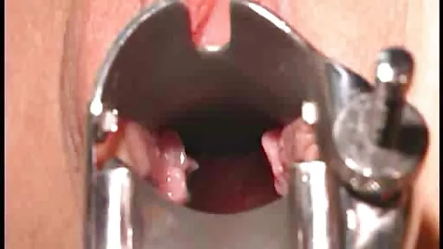 تسلیم, پخش سریع سکس عضو